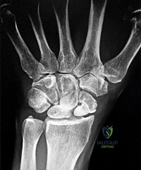 Orthopedic Surgery Mock Exam - Set EE0B0A