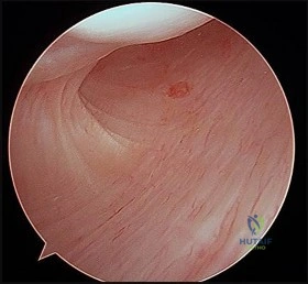 صورة طبية: دليل شامل لصحة العظام والمفاصل: استشارات وإجابات مع الأستاذ الدكتور محمد هطيف في صنعاء