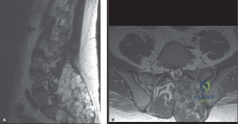 Clinical Image
