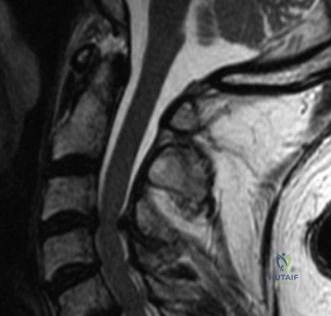 Clinical Image