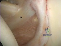 أدوات الجراحة المجهرية الدقيقة لإصلاح الأعصاب والأوعية الدموية