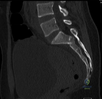 Clinical Image