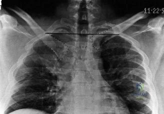 صورة طبية: آلام الكتف والمرفق: دليلك الشامل للتشخيص الدقيق والعلاج الفعال في صنعاء مع الأستاذ الدكتور محمد هطيف