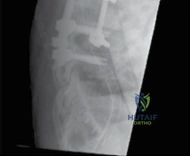 صورة لجهاز التصوير بالرنين المغناطيسي (MRI)