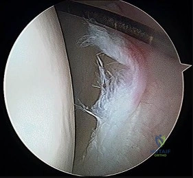 صورة توضيحية لـ دليل شامل لصحة العظام والمفاصل: استشارات وإجابات مع الأستاذ الدكتور محمد هطيف في صنعاء