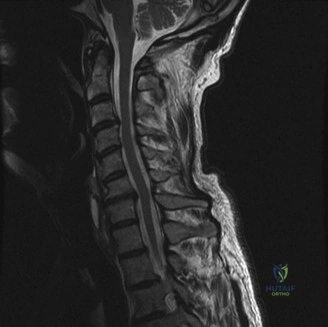 Clinical Image