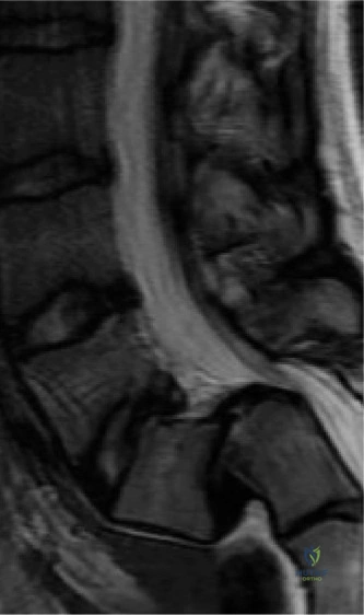 Clinical Image