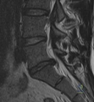 Clinical Image