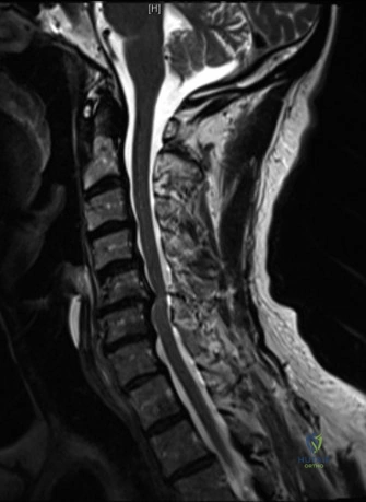 Clinical Image