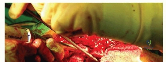 Hutaif Orthopedic Center: A Leading Provider of Orthopedic Care in Yemen