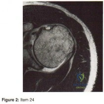 Orthopedic Surgery Board Review MCQs: AAOS Master Bank Part 103