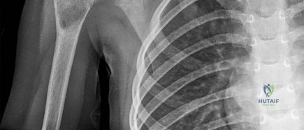 صورة توضيحية لـ دليل شامل لصحة العظام والمفاصل: استشارات وإجابات مع الأستاذ الدكتور محمد هطيف في صنعاء