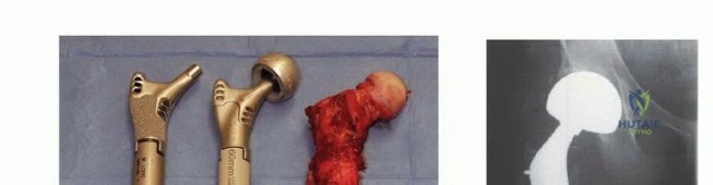 FRCS EMQs: Knee