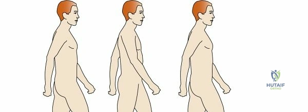 صورة توضيحية لـ إعادة التأهيل الحركي: فهم المشي، البتر، الأطراف الصناعية، الجبائر، وإصابات الجهاز العصبي مع الأستاذ الدكتور محمد هطيف