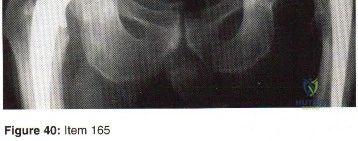 Orthopedic Surgery Board Review MCQs: AAOS Master Bank Part 45