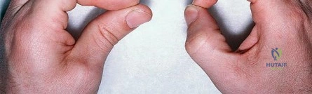 وصف طبي دقيق ومبسط للمريض