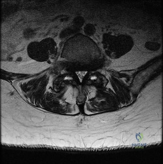 Clinical Image
