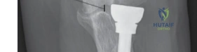 Clinical Image