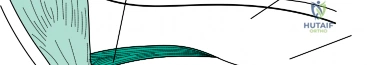 Clinical Image