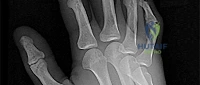 Illustration of orthopedic mcqs free - Dr. Mohammed Hutaif