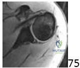 Orthopedic O Upper Extremity Review | Dr Hutaif General -...