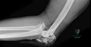 High-Yield Orthopedic Board Review MCQs