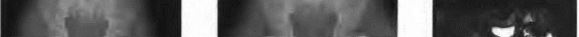 Pediatric Ortho MCQs: Can You Answer This Figure B Question?