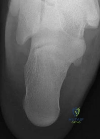 Orthopedic Reconstruction MCQs: Here, the question is question.