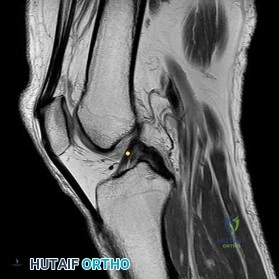 Master Orthopedic Imaging: Select the Preferred Response Figure