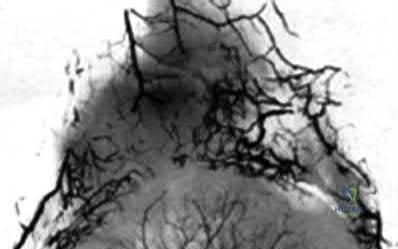 Orthopedic Trauma MCQ: Unlock the corrent answer figure here