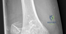 Orthopedic Basic Review | Dr Hutaif Basic Science Revie -...