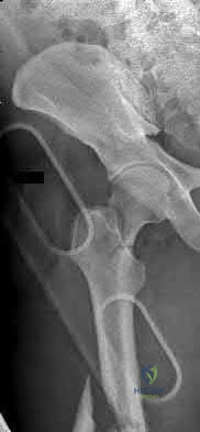 Illustration 109 for OrthoCash: Trauma MCQs & Cases for a yearold woman