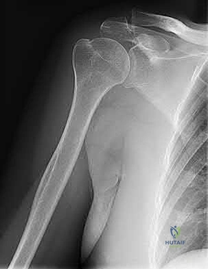 Illustration 149 for OrthoCash: Trauma MCQs & Cases for a yearold woman