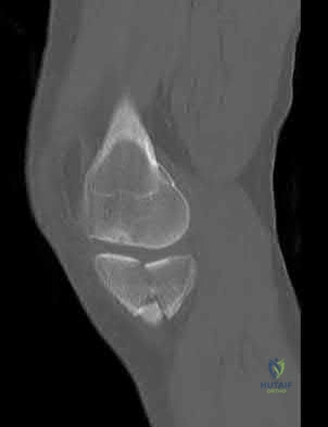 Illustration 186 for OrthoCash: Trauma MCQs & Cases for a yearold woman
