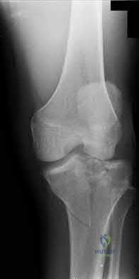Illustration 161 for OrthoCash: Trauma MCQs & Cases for a yearold woman
