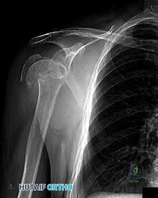Illustration 209 for OrthoCash: Trauma MCQs & Cases for a yearold woman