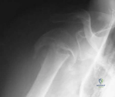 Illustration 84 for OrthoCash: Trauma MCQs & Cases for a yearold woman