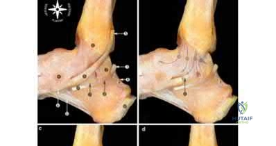 Illustration 101 for OrthoCash: Trauma MCQs & Cases for a yearold woman