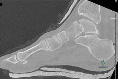 Illustration 157 for OrthoCash: Trauma MCQs & Cases for a yearold woman