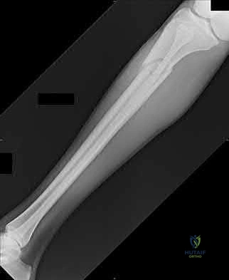 Illustration 204 for OrthoCash: Trauma MCQs & Cases for a yearold woman