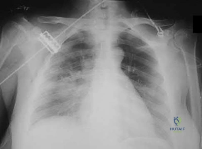 Illustration 132 for OrthoCash: Trauma MCQs & Cases for a yearold woman