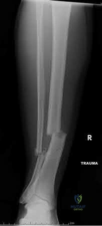 Illustration 1 for OrthoCash: Trauma MCQs & Cases for a yearold woman