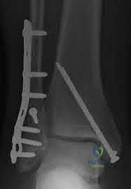 Illustration 8 for OrthoCash: Trauma MCQs & Cases for a yearold woman