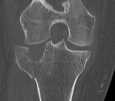 Illustration 26 for OrthoCash: Trauma MCQs & Cases for a yearold woman