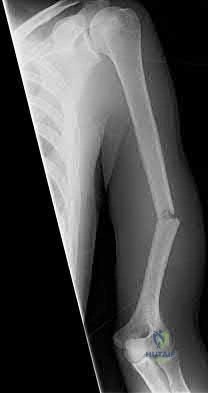 Illustration 173 for OrthoCash: Trauma MCQs & Cases for a yearold woman