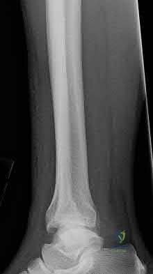 Illustration 143 for OrthoCash: Trauma MCQs & Cases for a yearold woman