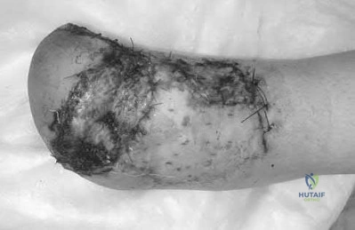 Illustration 160 for OrthoCash: Trauma MCQs & Cases for a yearold woman