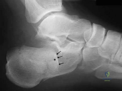 Illustration 18 for OrthoCash: Trauma MCQs & Cases for a yearold woman