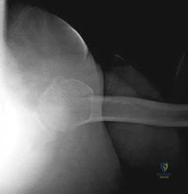 Illustration 181 for OrthoCash: Trauma MCQs & Cases for a yearold woman