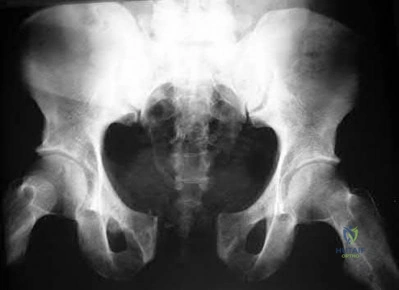 Illustration 207 for OrthoCash: Trauma MCQs & Cases for a yearold woman